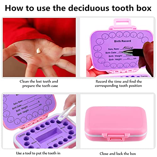 EasyULT Caja para Guardar Dientes para Niños y Niñas, Caja para Dientes de Leche, Caja para Guardar Dientes, Acumulación de Dientes, para Guardar Dientes para Little Bebé(rosado)