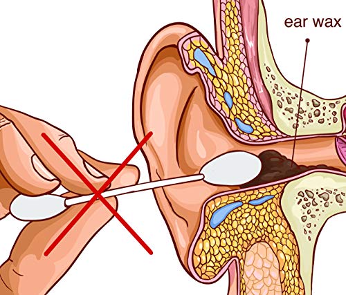 REMOS limpiador de oídos de acero inoxidable para eliminar el cerumen 14cm